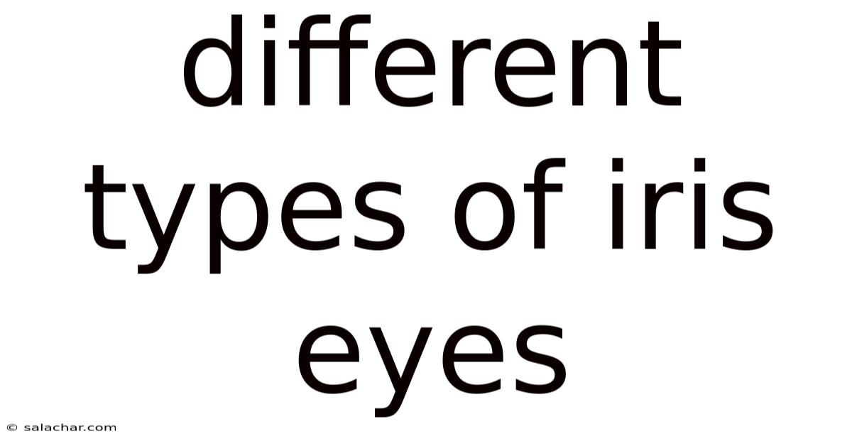 Different Types Of Iris Eyes